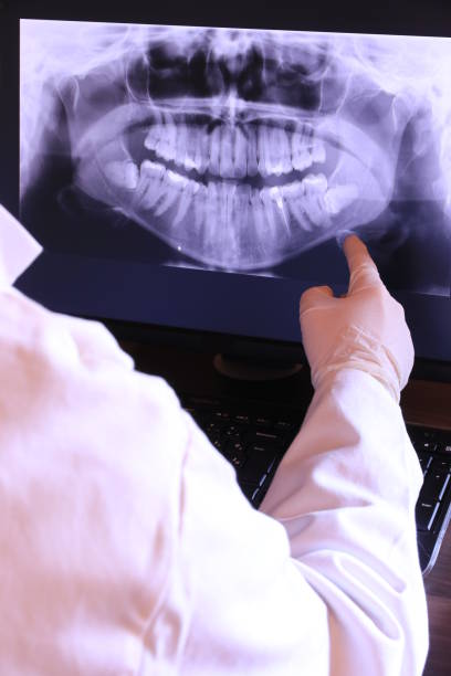 Best Emergency Dentist for Lost Fillings or Crowns in Boronda, CA