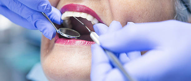 Best Urgent Dental Care for Toothache in Boronda, CA